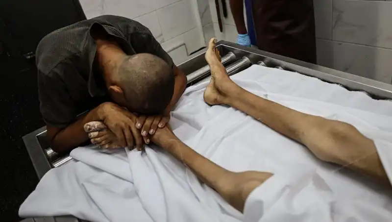 Gazze'de Açlık Krizi: Bir Çocuk Daha Hayata Veda Etti