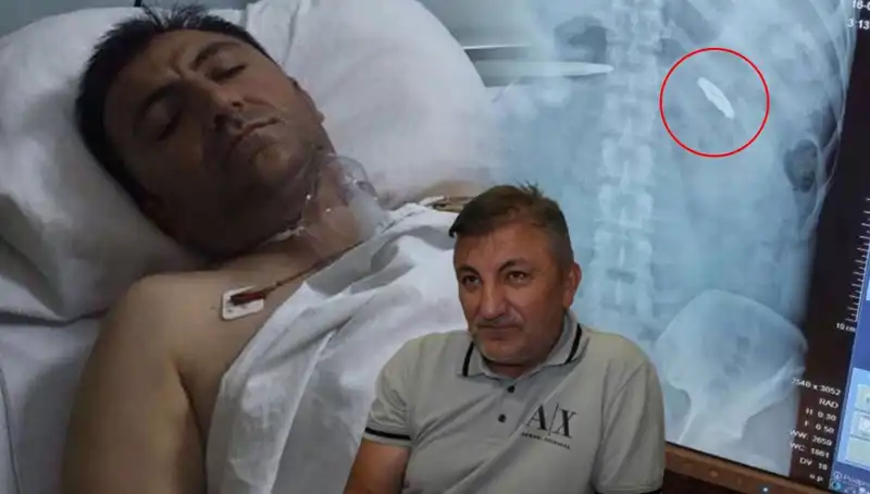 15 Temmuz’dan Bugüne: Vücudunda Kurşunla Taşıdığı Acı Hatıra