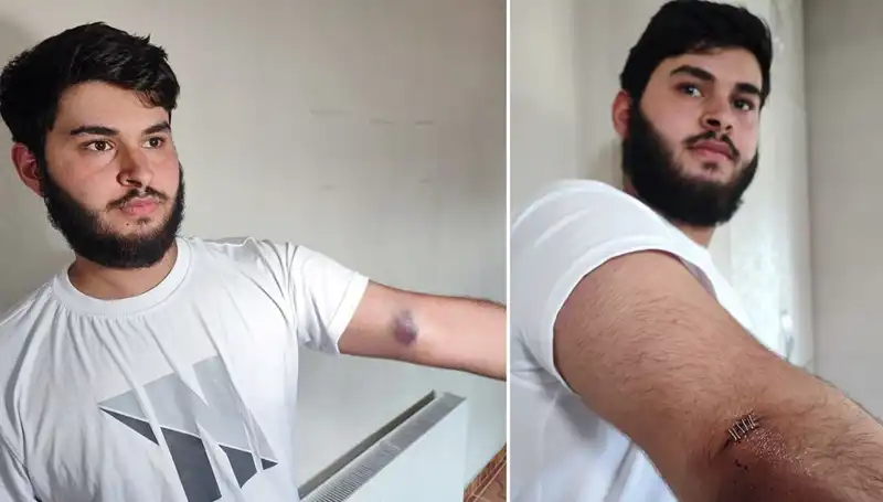 Bahçeye Kaçan Top Mahalleyi Karıştırdı: Conolar Ne Olacak?